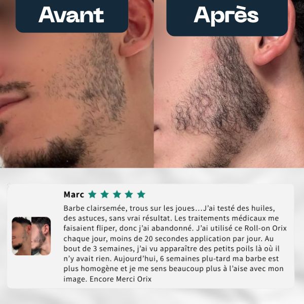 Sérum Activateur de Pousse