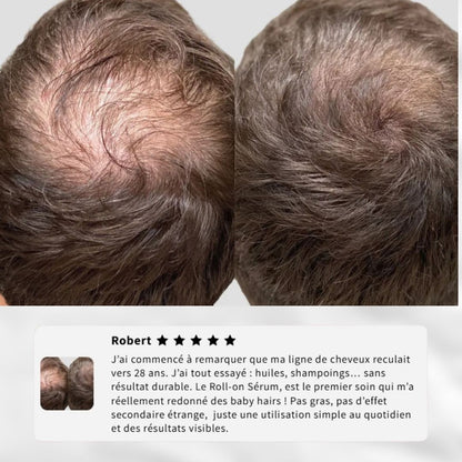 Sérum Capilaire Roll-On